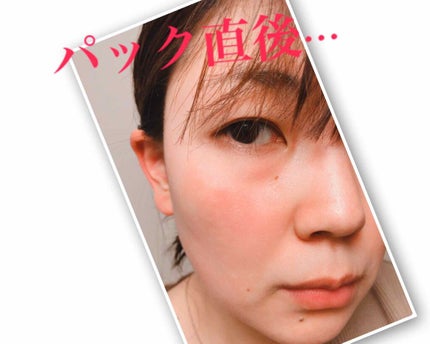 オリジナル ピュアスキンジェリー/ヴァセリン/ボディクリームを使ったクチコミ(3枚目)