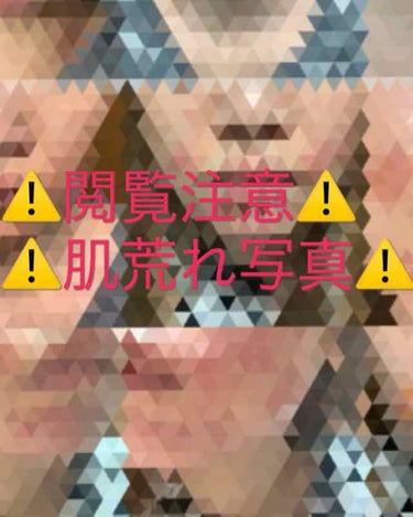 にゃも on LIPS 「初めまして🙋‍♀️✨最近肌の調子が良くなり、悩んでたのが嘘みた..」（1枚目）