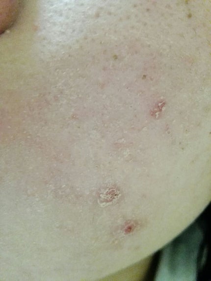 カラーコンシーラー/セラフォア/リキッドコンシーラーを使ったクチコミ(4枚目)