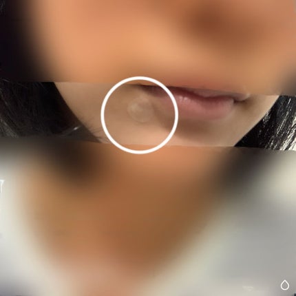 プロCICA クリアスポットパッチ/VT/その他スキンケアを使ったクチコミ(3枚目)