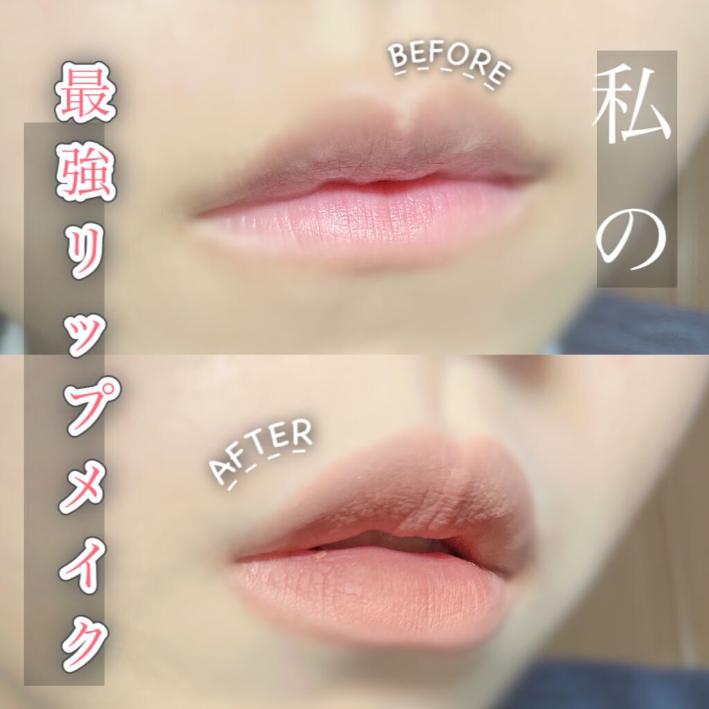 薬用固形パウダー/ピジョン/ボディパウダーを使ったクチコミ（1枚目）