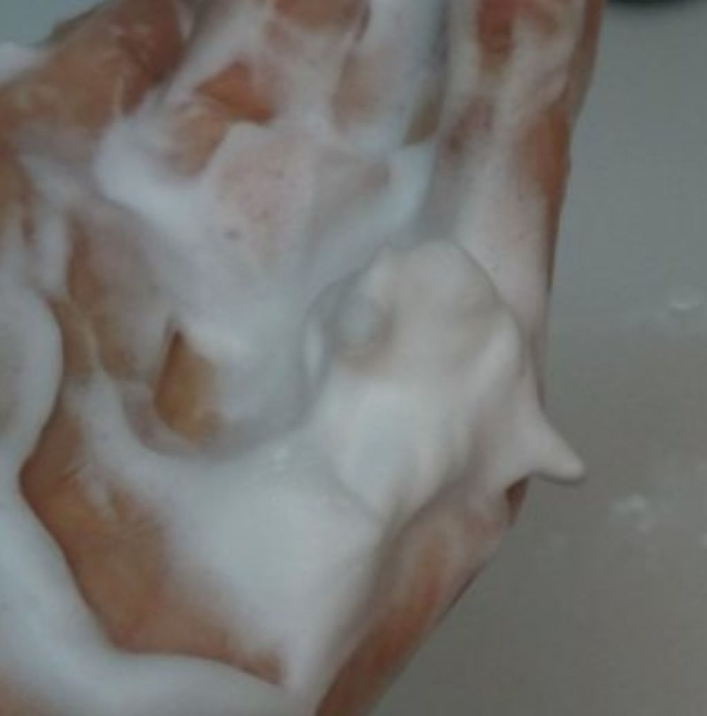 薬用 アクネケア クリアローション/DAISO/化粧水を使ったクチコミ(2枚目)