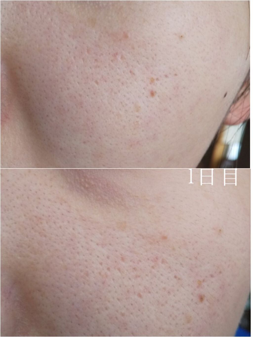 スキンクリア クレンズ オイル アロマタイプ/アテニア/オイルクレンジングを使ったクチコミ(2枚目)