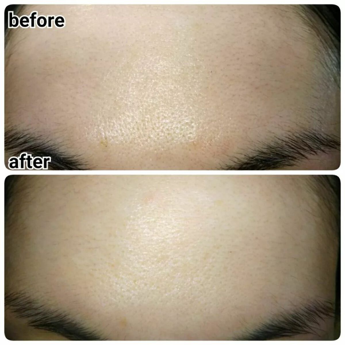 nangokudiver on LIPS 「医薬部外品のクリームで、シワを改善してくれる有効成分・ナイアシ..」(4枚目)