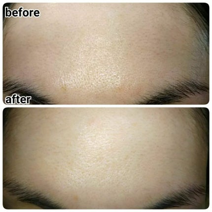 nangokudiver on LIPS 「医薬部外品のクリームで、シワを改善してくれる有効成分・ナイアシ..」(4枚目)