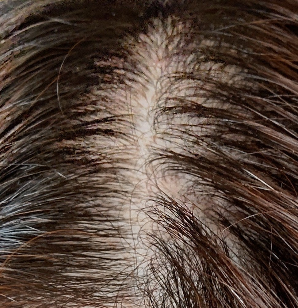 スカルプローション/Rintor/頭皮ローションを使ったクチコミ(2枚目)