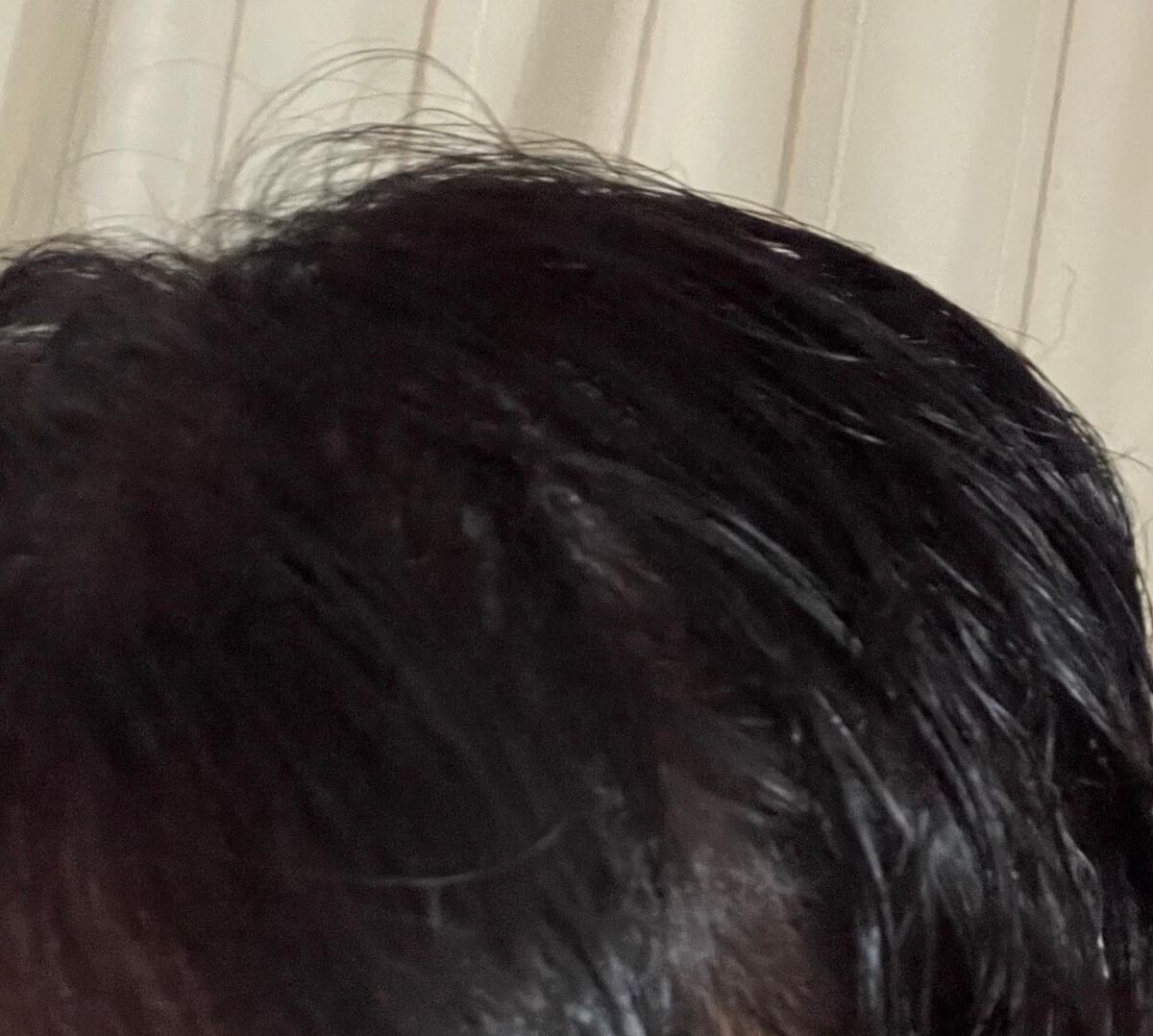 薬用スカルプセラム/wicot/頭皮ローションを使ったクチコミ(4枚目)