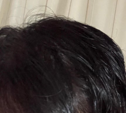 薬用スカルプセラム/wicot/頭皮ローションを使ったクチコミ(4枚目)