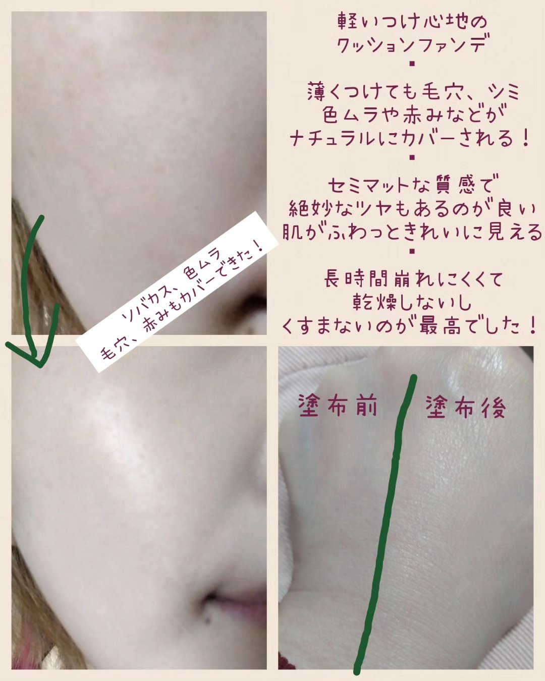 ダーマシンコンシーラー/23years old/リキッドコンシーラーを使ったクチコミ（3枚目）