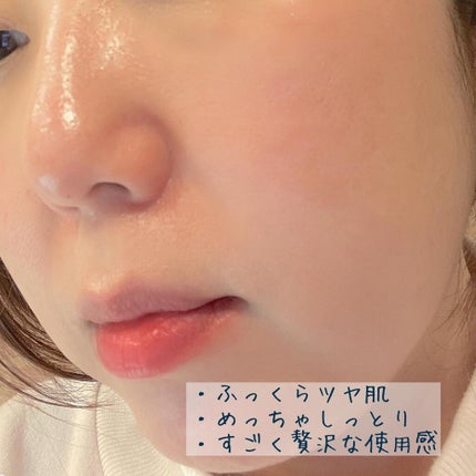 プレミアムトリートメントマスク/SUIKO HATSUCURE/シートマスク・パックを使ったクチコミ(5枚目)