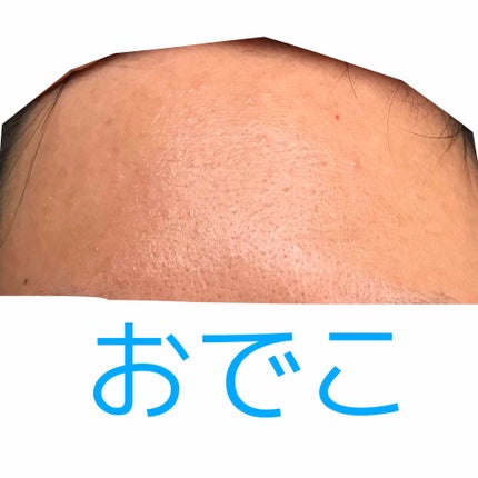 ハトムギ化粧水(ナチュリエ スキンコンディショナー R )/ナチュリエ/化粧水を使ったクチコミ(2枚目)