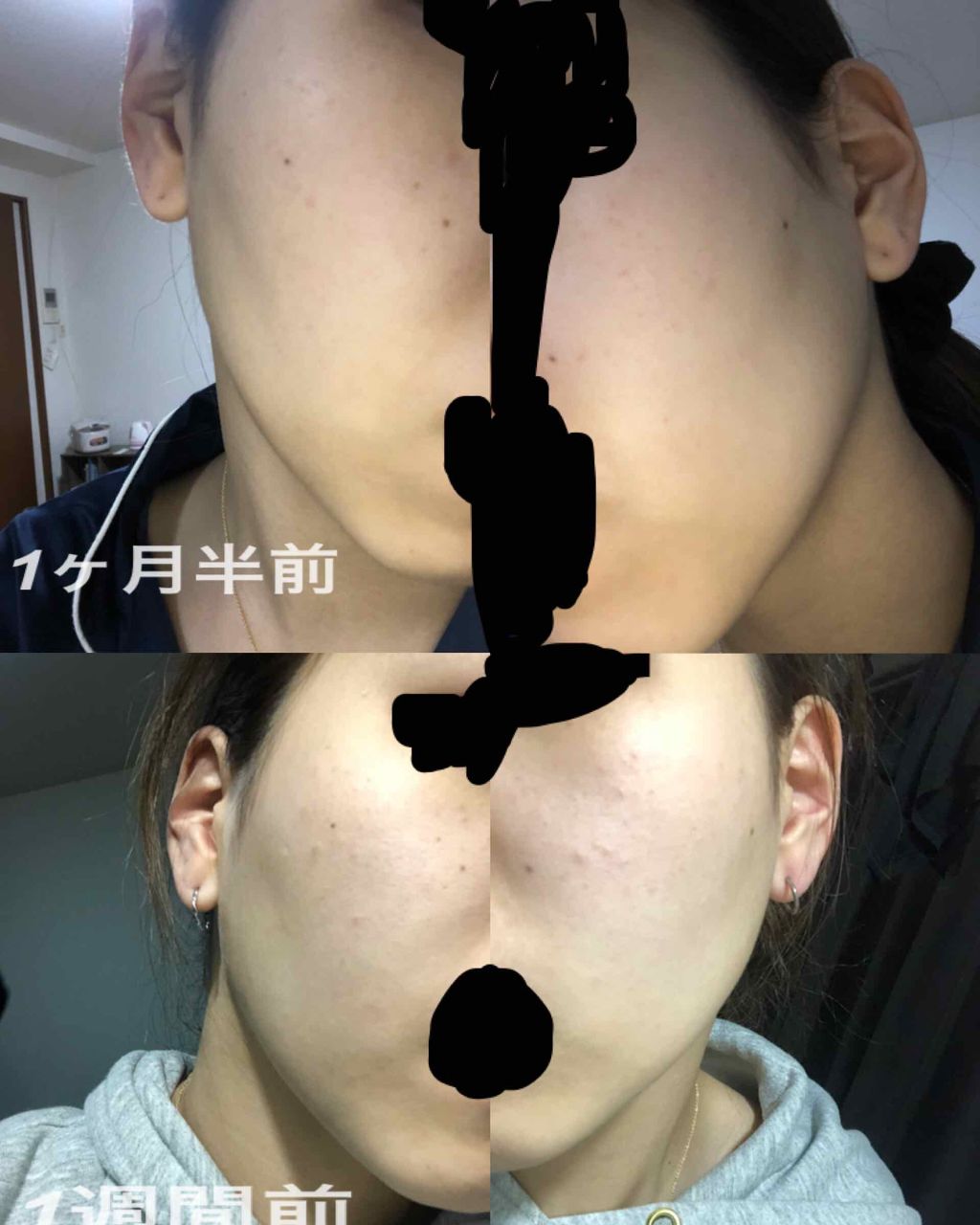 DHC はとむぎエキス/DHC/健康サプリメントを使ったクチコミ(1枚目)