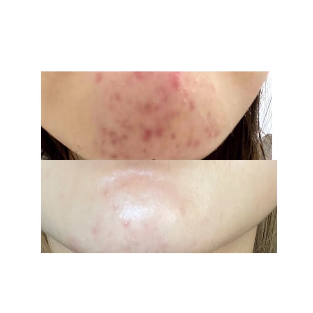 潤浸保湿 化粧水 III とてもしっとり/キュレル/化粧水を使ったクチコミ(3枚目)