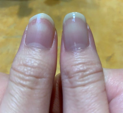 エルファー ネイルキッスC/DAISO/除光液を使ったクチコミ(8枚目)