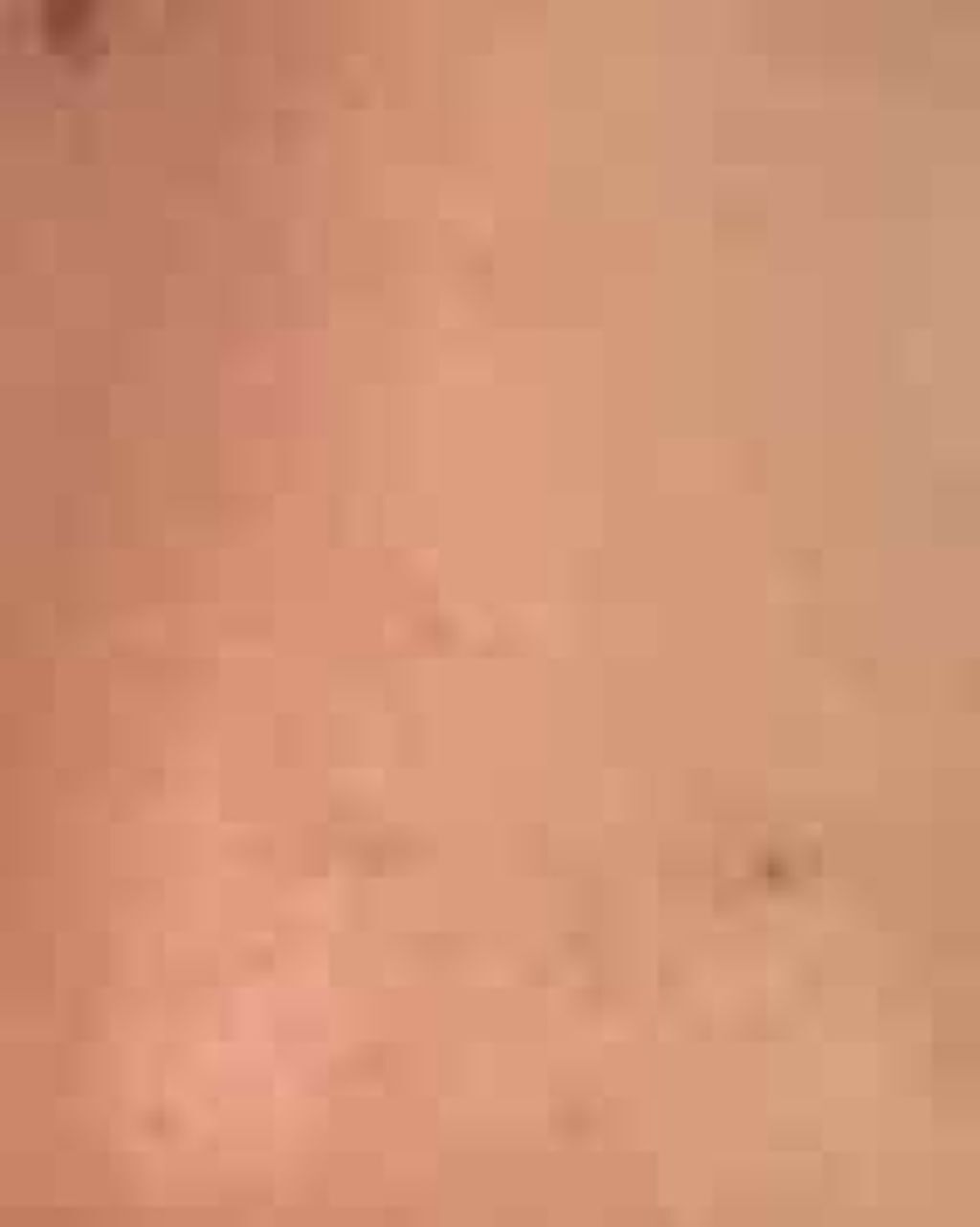 常に金欠 on LIPS 「鼻の黒ずみ?がやばくて、実際に見るとすごいんです。これで学校行..」(3枚目)