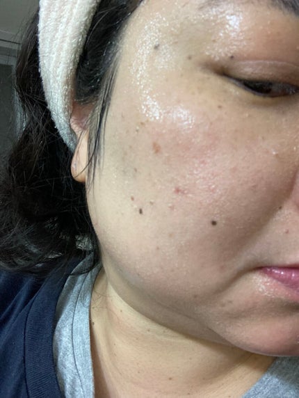 パチパチはたらくメイク落とし/ビオレ/クレンジングウォーターを使ったクチコミ(6枚目)