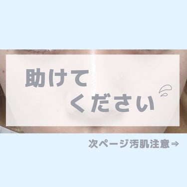 メラノCC ディープクリア酵素洗顔	のクチコミ「はじめまして。
私は現在高校2年生です🎀

2.3年程前から、肌の事(毛穴・にきび跡・肌.....」（1枚目）