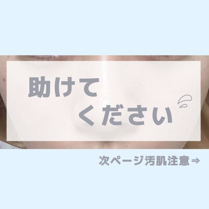 CICA ケアクリーム/BEAUSTA/フェイスクリームを使ったクチコミ(1枚目)