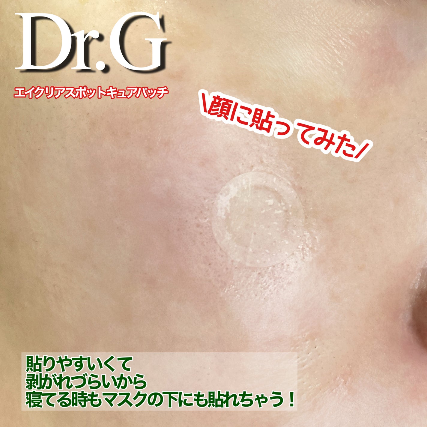 Dr.G Aクリアスポットパッチ/Dr.G/その他スキンケアを使ったクチコミ(3枚目)