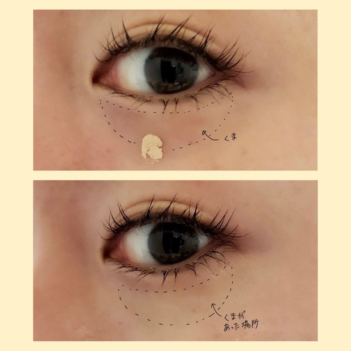 マスクフィットオールカバーデュアルコンシーラー/TIRTIR(ティルティル)/コンシーラーを使ったクチコミ(6枚目)