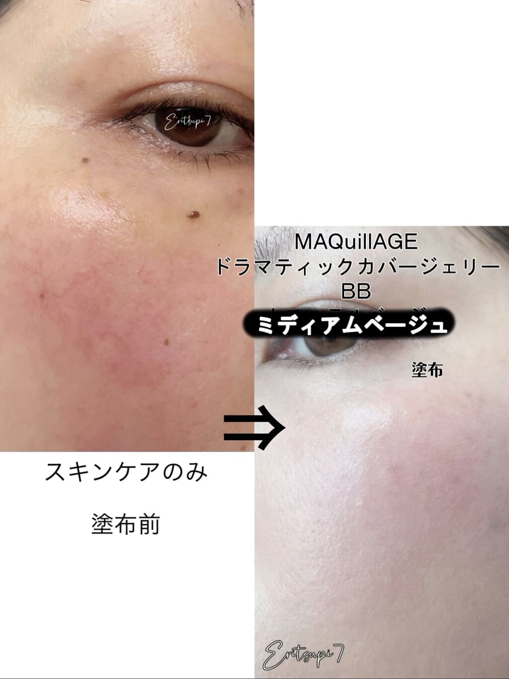 ドラマティック カバージェリー BB		 ミディアムベージュ/マキアージュ/BBクリームを使ったクチコミ（3枚目）