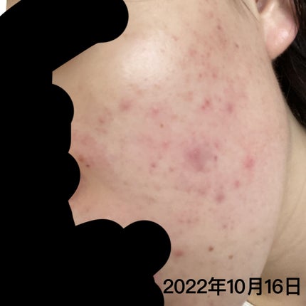 ミノン アミノモイスト モイストチャージ ミルク/ミノン/乳液を使ったクチコミ(1枚目)