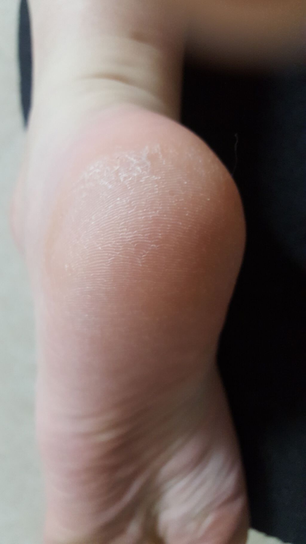 薬用 フットソープF1 フレッシュハーブ/フットメジ/レッグ・フットケアを使ったクチコミ（1枚目）