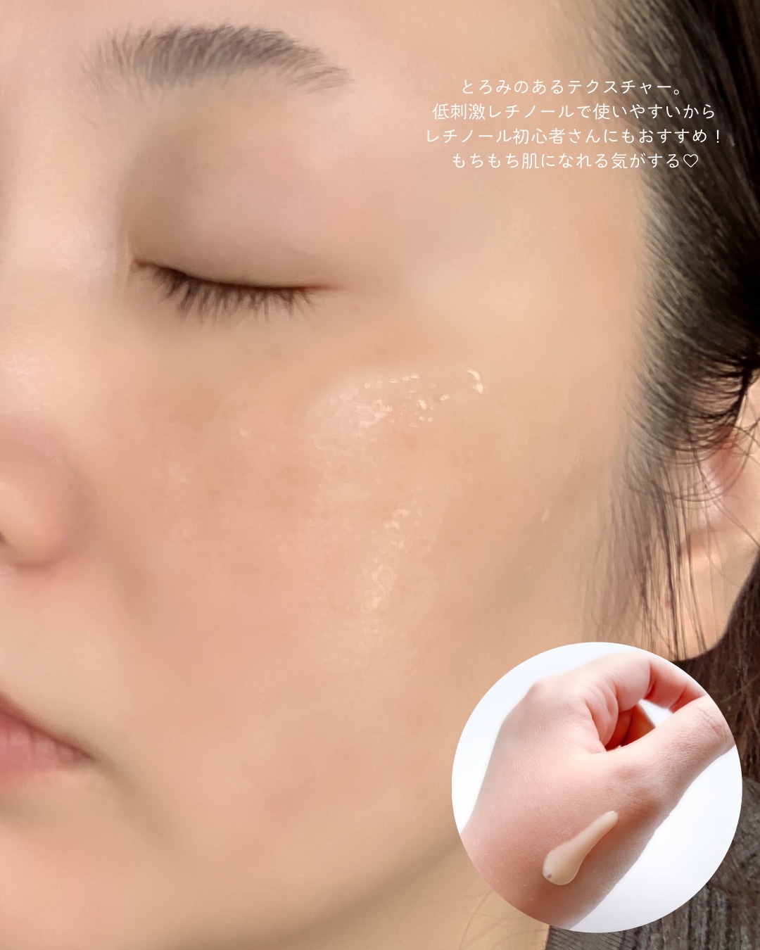 ブラックスネイル クリーム/Dr.G/フェイスクリームを使ったクチコミ（3枚目）