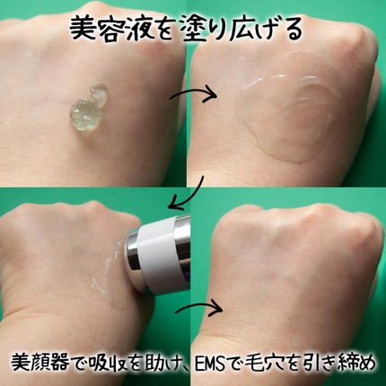 ポアセラショットエクソソームスピキュールセラム& ミニマイザー美顔/MEDITHERAPY/美容液を使ったクチコミ(6枚目)