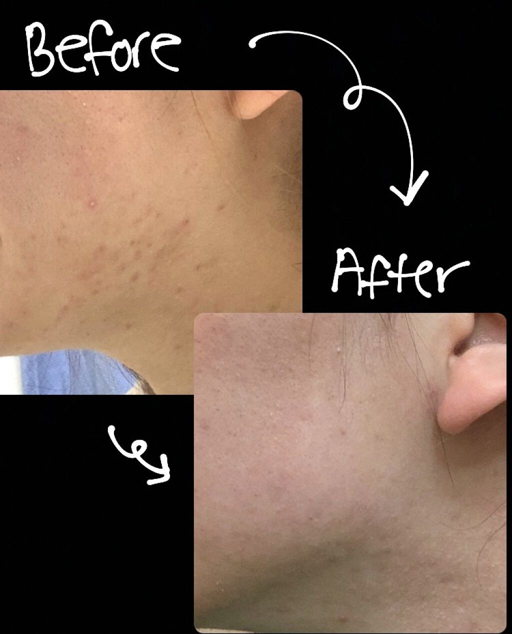 スキンアクア トーンアップUVエッセンス/スキンアクア/日焼け止めクリームを使ったクチコミ（1枚目）