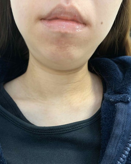 リップフォンデュ/メンソレータム/リップバームを使ったクチコミ(2枚目)