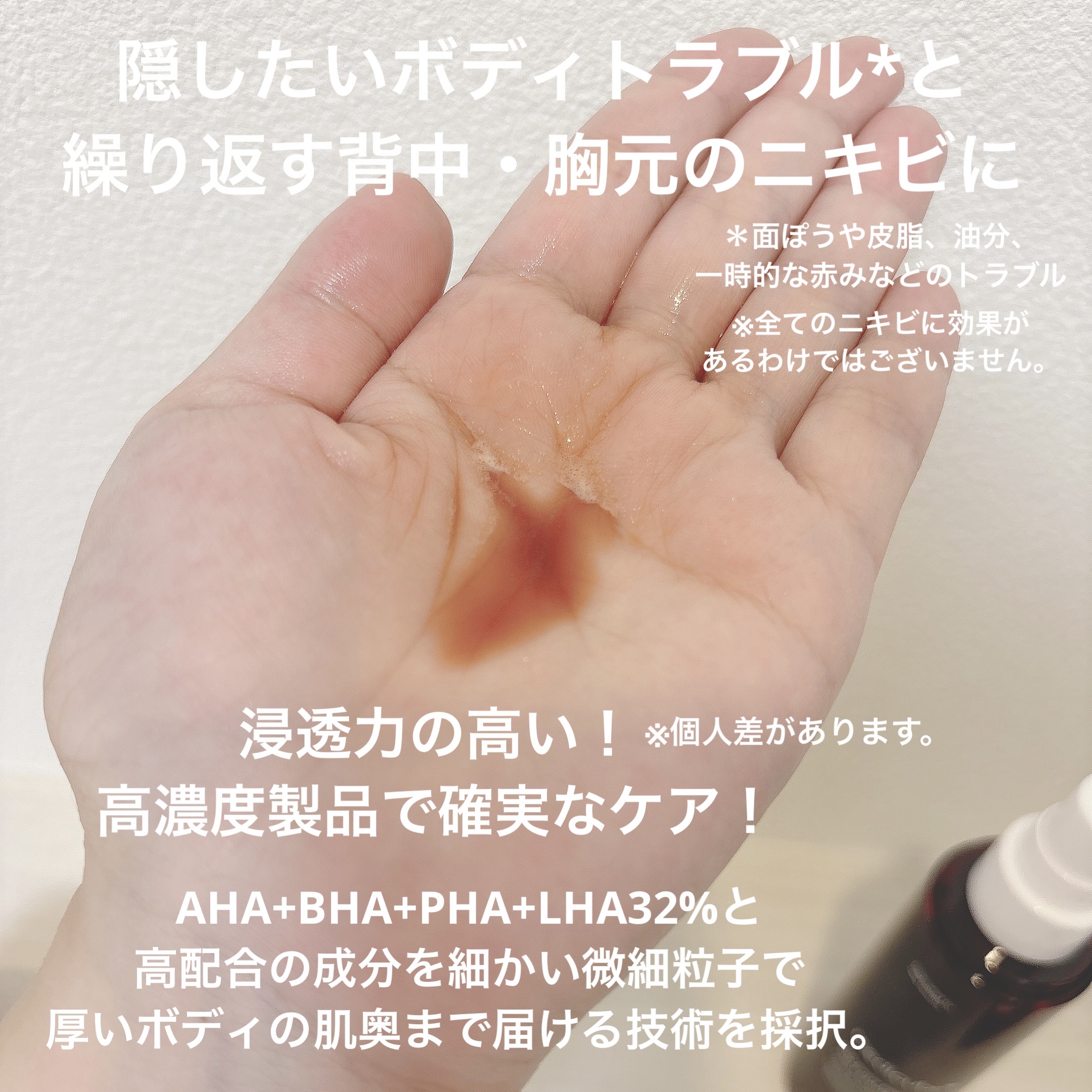 レッドアクネ ボディピーリングショット/MEDICUBE/ピーリングを使ったクチコミ（2枚目）