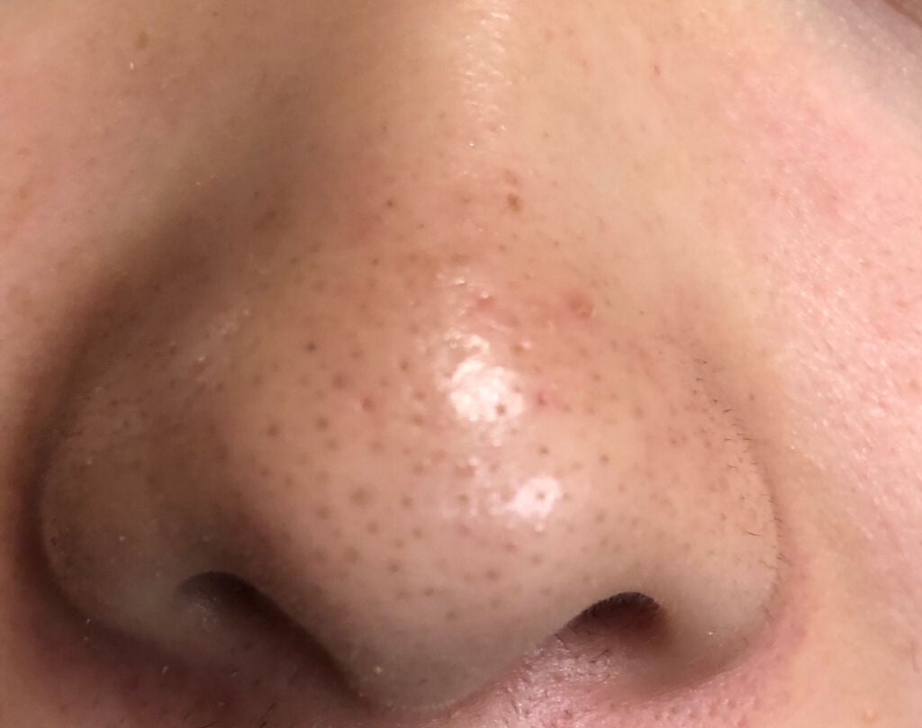 ノーモアブラックヘッド(ノーズピーリング)/One-day's you/スクラブ・ゴマージュを使ったクチコミ(2枚目)