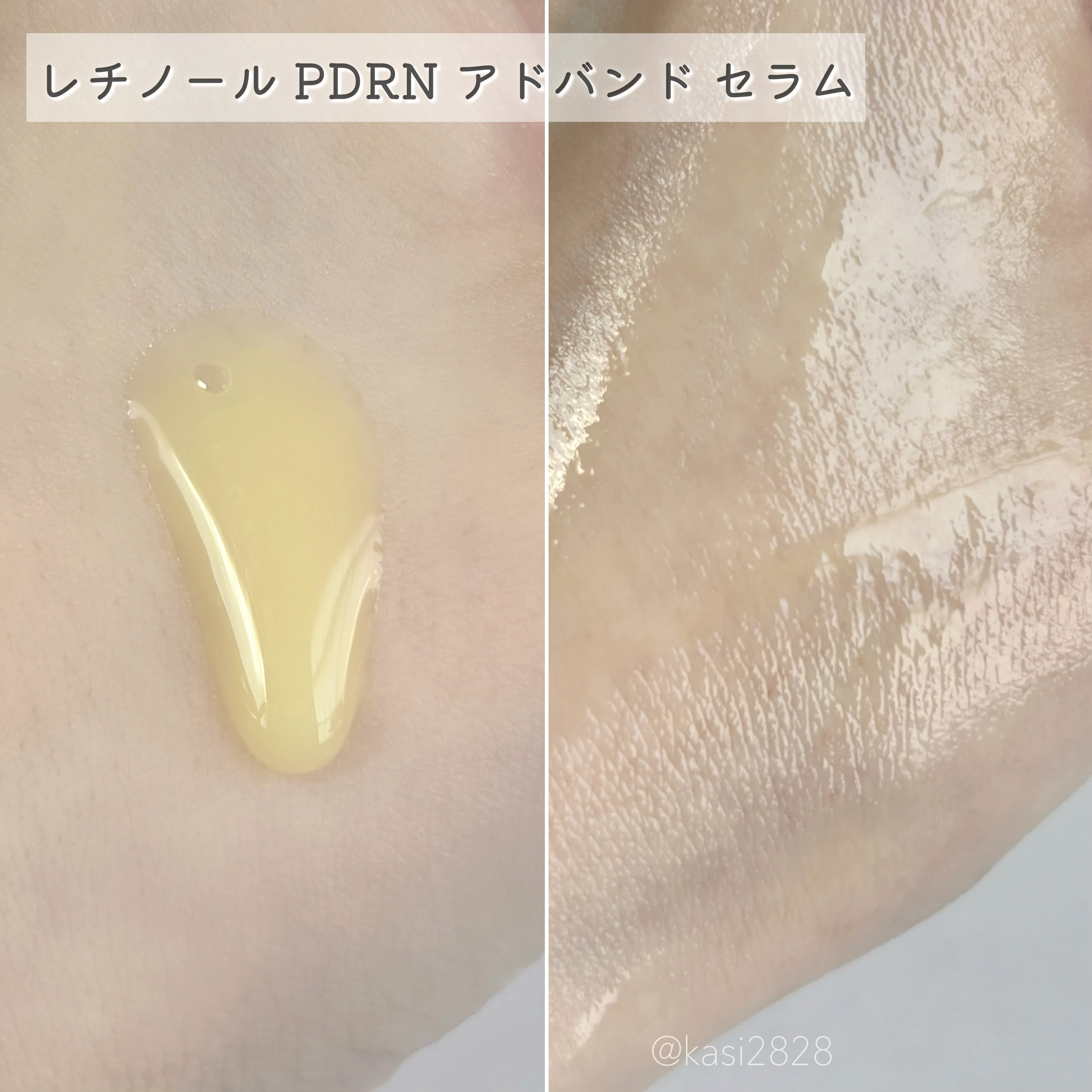 レチノール　シカ　リペア　セラム/innisfree/美容液を使ったクチコミ（3枚目）