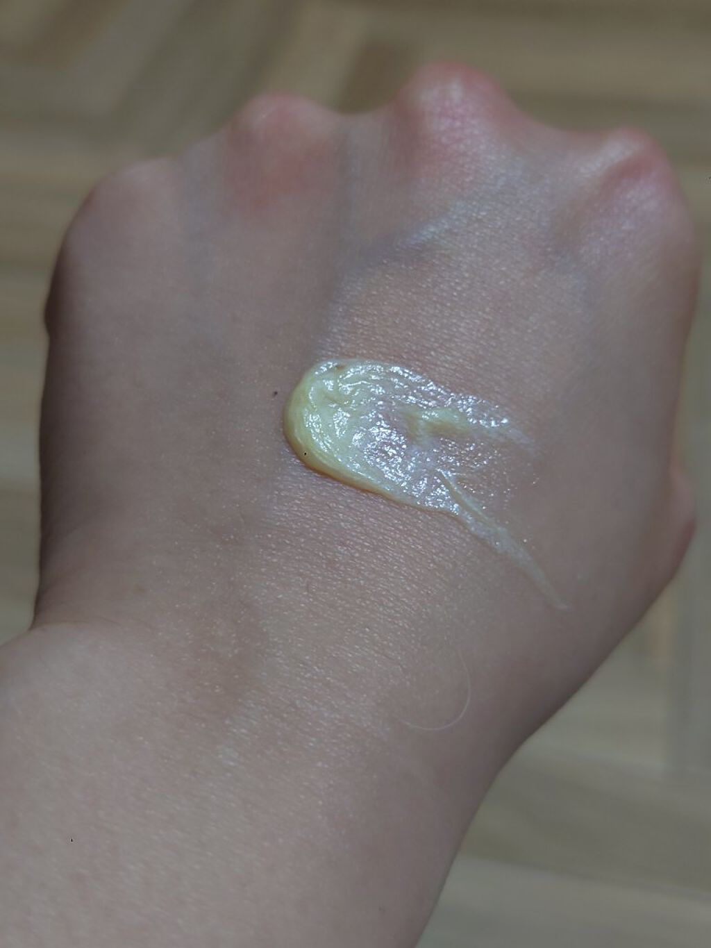 ユースキン/ユースキン/ボディクリームを使ったクチコミ（2枚目）