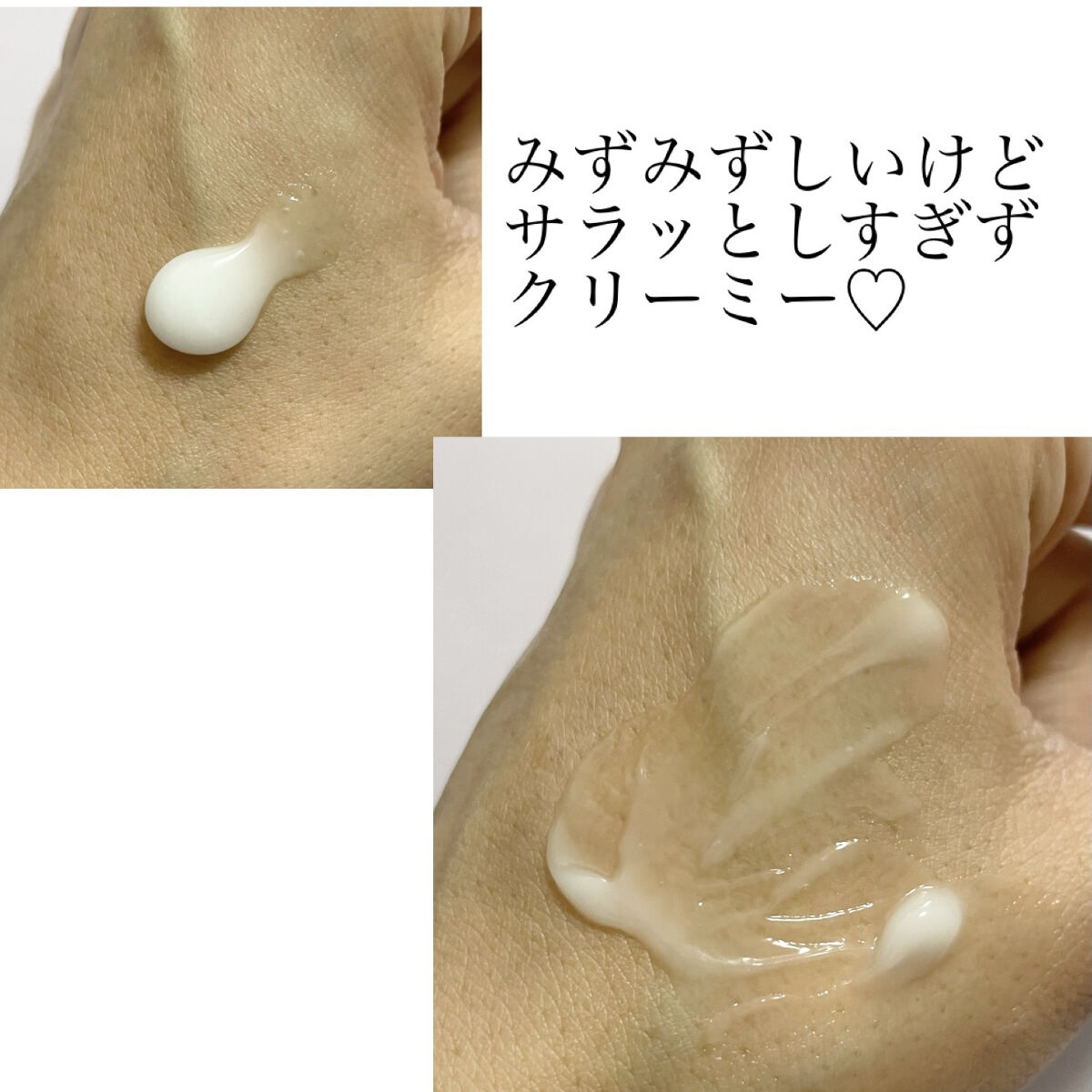 ウォータードロップスージングクリーム/Acne Cat/フェイスクリームを使ったクチコミ（2枚目）