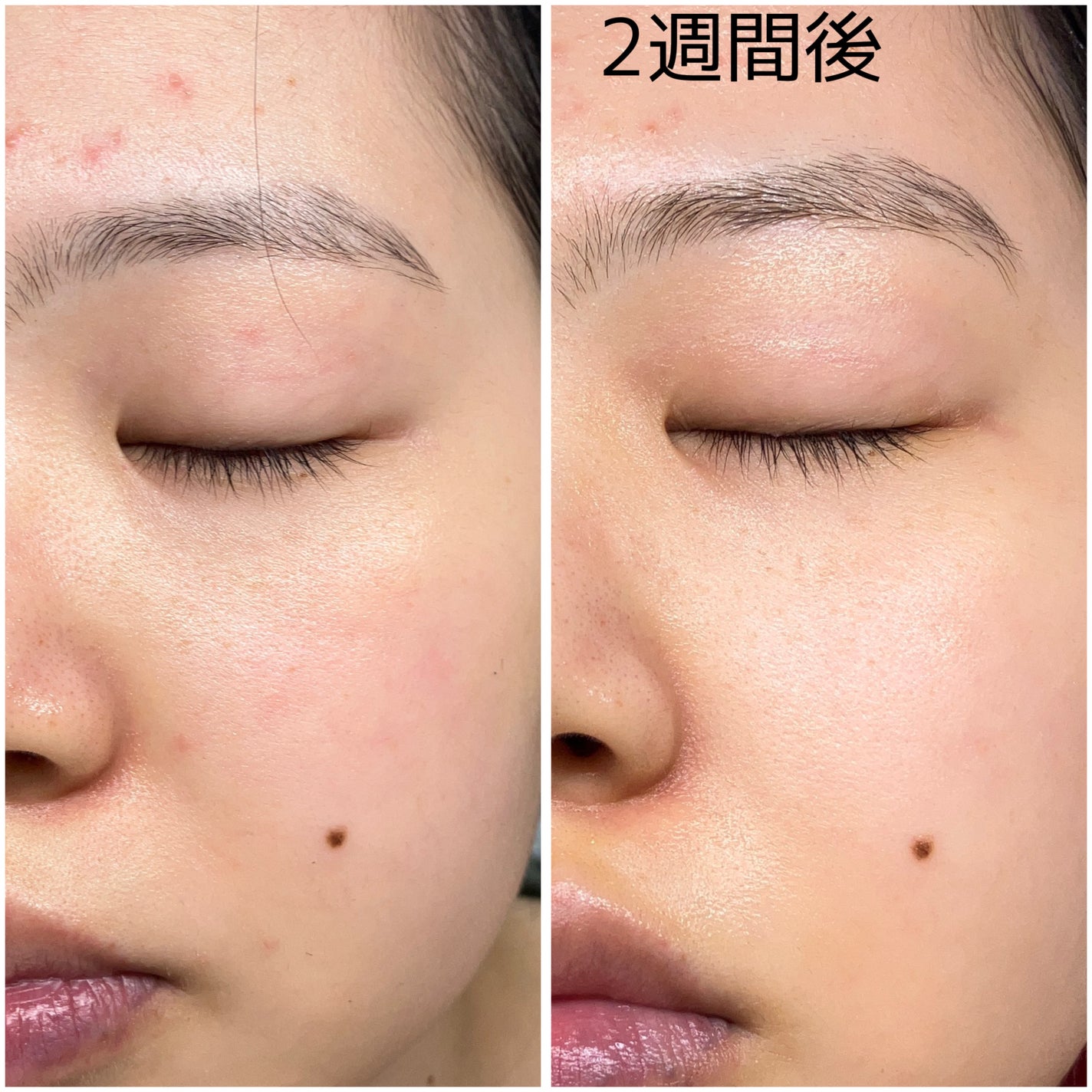 ディープビタCアンプル2.0/MEDICUBE/美容液を使ったクチコミ(3枚目)