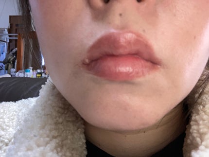 クレ・ド・ポー ボーテ ブリアンアレーブルエクラ/クレ・ド・ポー ボーテ/リップグロスを使ったクチコミ(5枚目)