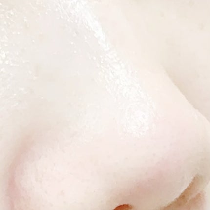 チョコブラ スペシャル毛穴ケアセット/Chocobra/スキンケアキットを使ったクチコミ(5枚目)