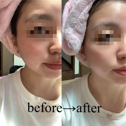 コラーゲンコアグローマスク/TIRTIR(ティルティル)/その他スキンケアを使ったクチコミ(5枚目)