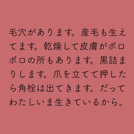 ミノン アミノモイスト モイストチャージ ミルク/ミノン/乳液を使ったクチコミ(3枚目)