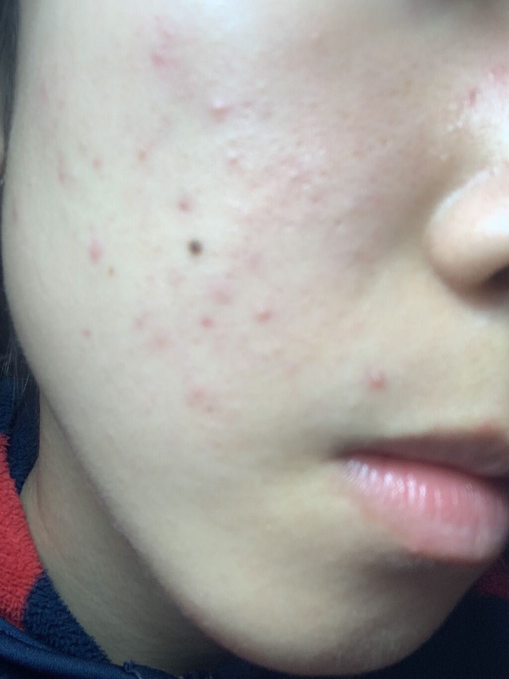 明色美顔水 薬用化粧水/美顔/化粧水を使ったクチコミ（2枚目）