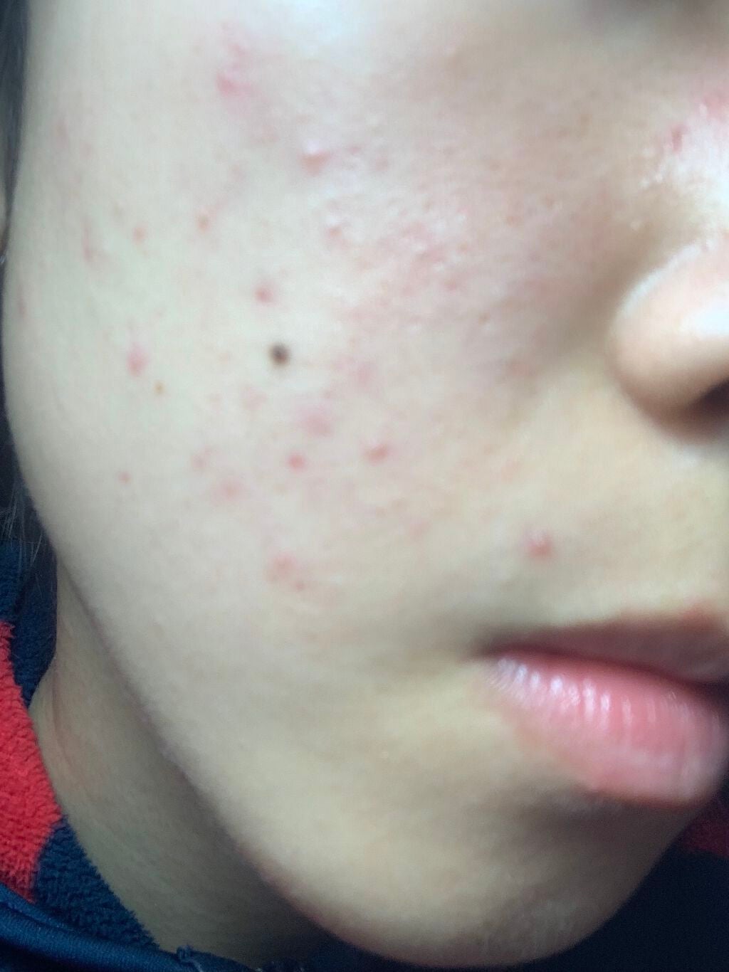 明色美顔水 薬用化粧水/美顔/化粧水を使ったクチコミ(2枚目)