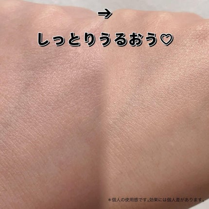 プロP ミスト/CNP Laboratory/ミスト状化粧水を使ったクチコミ(5枚目)