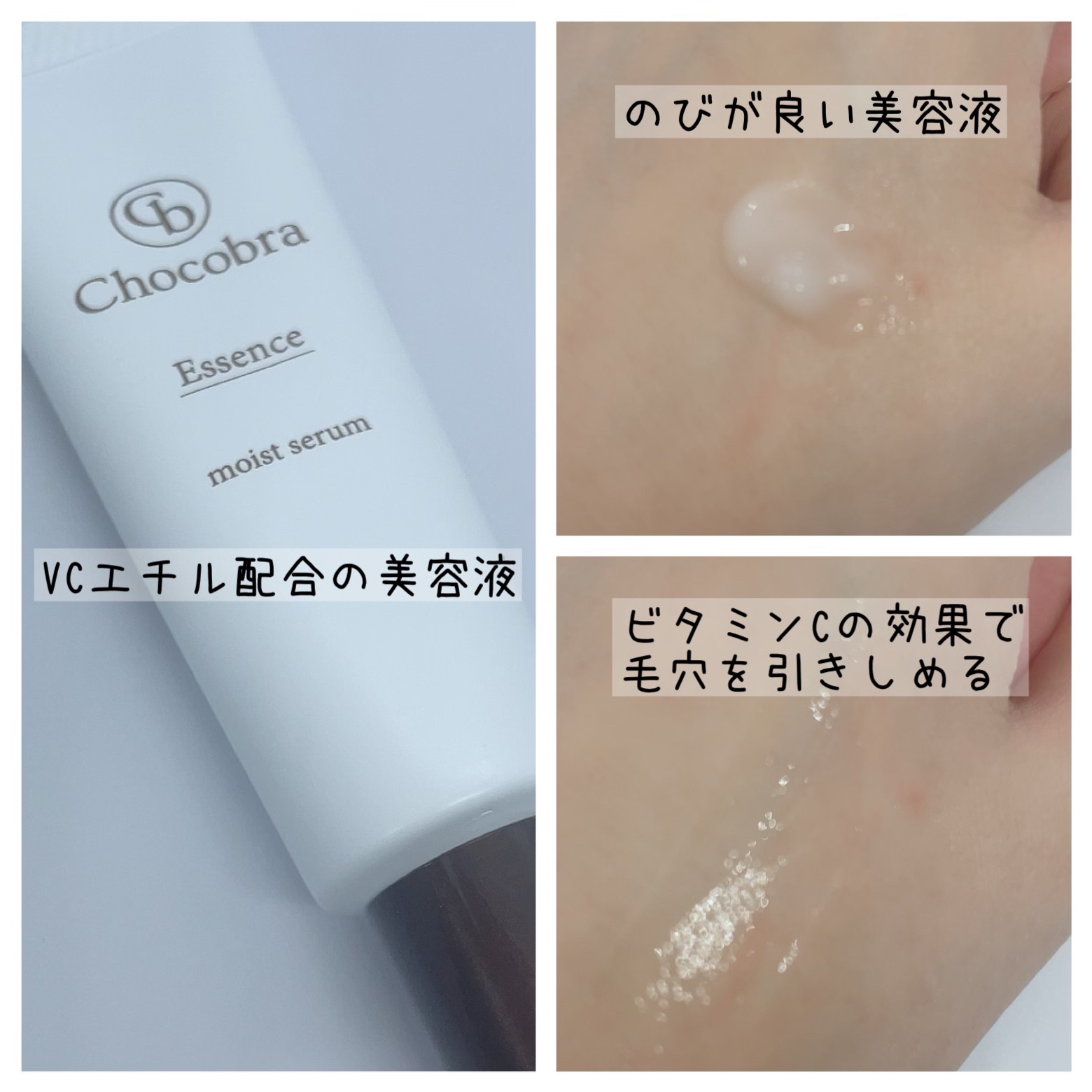 チョコブラ スペシャル毛穴ケアセット/Chocobra/スキンケアキットを使ったクチコミ（3枚目）