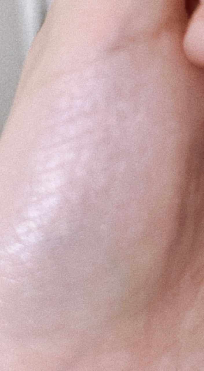 クリームチーク(パールタイプ)/キャンメイク/ジェル・クリームチークを使ったクチコミ(5枚目)