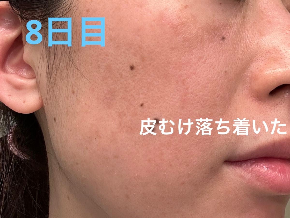 ゼオ美さん on LIPS 「ゼオスキン マイルドコース8日目夜☆バランサートナー☆デイリー..」(1枚目)