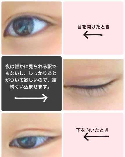 アイテープ(絆創膏タイプ、レギュラー、70枚)/DAISO/二重まぶた用アイテムを使ったクチコミ(1枚目)