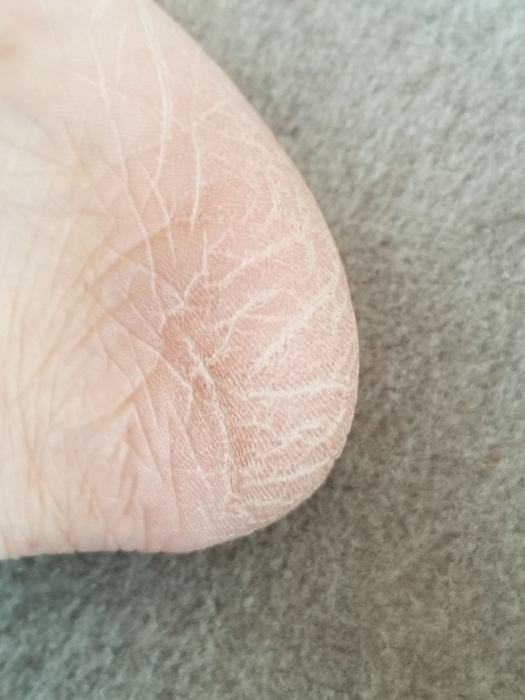 グリセリンカリ液/健栄製薬/ハンドクリームを使ったクチコミ（2枚目）