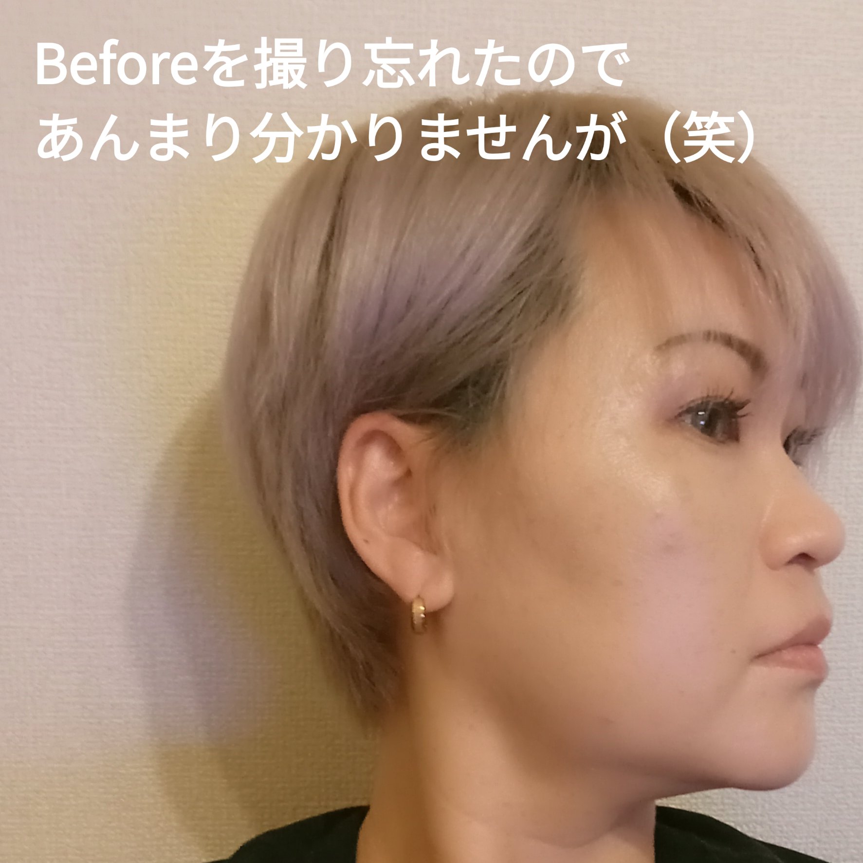 GB ヘアセルフカット セット/ギャツビー/ヘアケアグッズを使ったクチコミ（3枚目）
